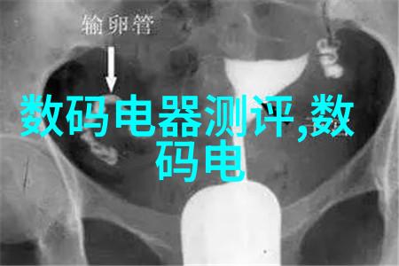 有限责任公司的法律框架与实践分析